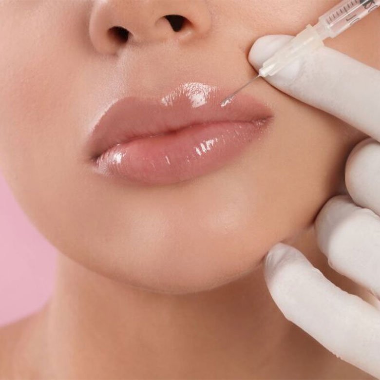 aumento-de-labios-Dra-Cynthia-Montenegro